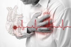 Инфаркт - причина атриовентрикулярной блокады