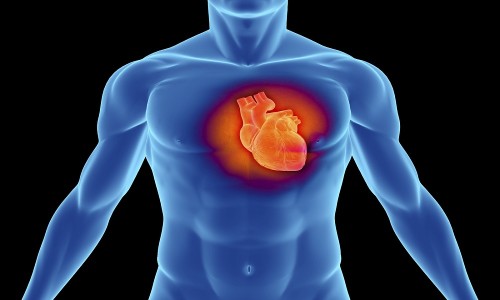 Болезнь серда - миокардический кардиосклероз