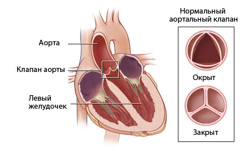 Устройство аортального клапана