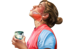 Процедура полоскания горла